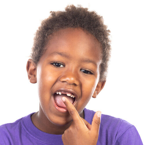 Child Showing his Missing Tooth