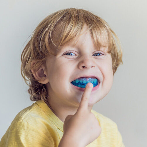 Little Boy Showing Blue Mouthguard